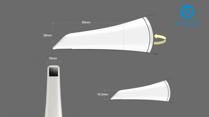 Comparación de resultados de escaneo intraoral