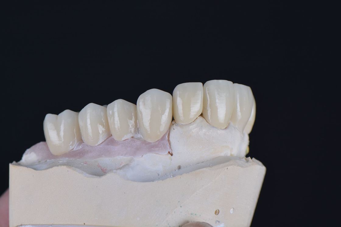 43%-57% Translucidez 700-1200 MPa Resistência à Flexão YUCERA Dental 98mm Open System CAD/CAM 4D Pro Multilayer Zirconia Block