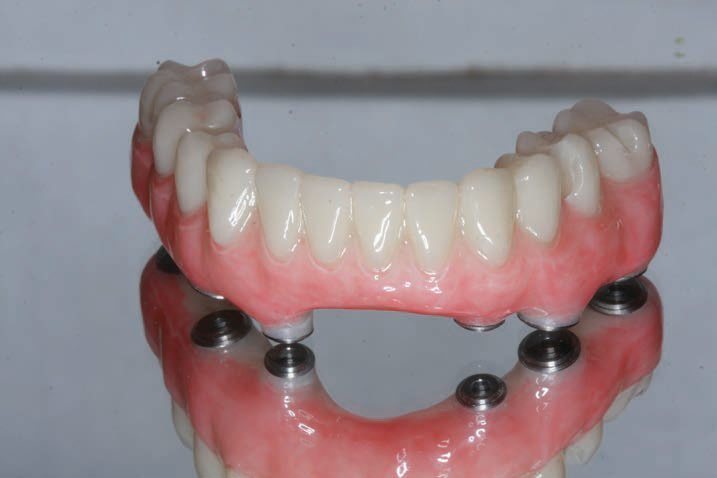 Blocos de PMMA Dentário Yucera 98*22mm  CADCAM Multicamadas PMMA Disco Rosa