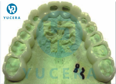 Material para Dentadura Flexível 16 Cores Rosa Transparente Disco Flexível PMMA Dental