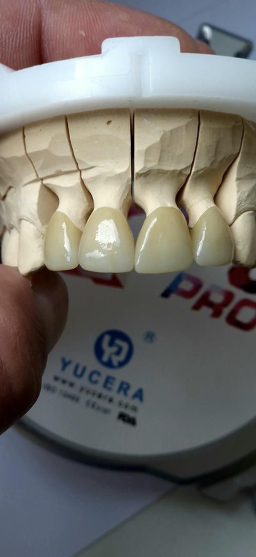 Yucera 4D Pro Dental Zirconia Ceramic Block - High-Quality Material for Dentists