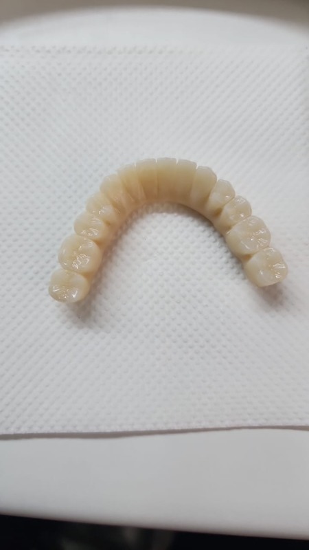 Bloco de Zircônia Dental Multicamadas 3D de Alta Precisão Yucera 4D Pro - Estável e Confiável, Criando Resultados Ideais de Restauração