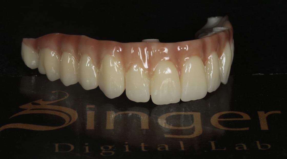 Disco de zircônia dental Yucera 4D Pro Multicamadas com gradiente de cores e cores padrão A1/A2/A3
