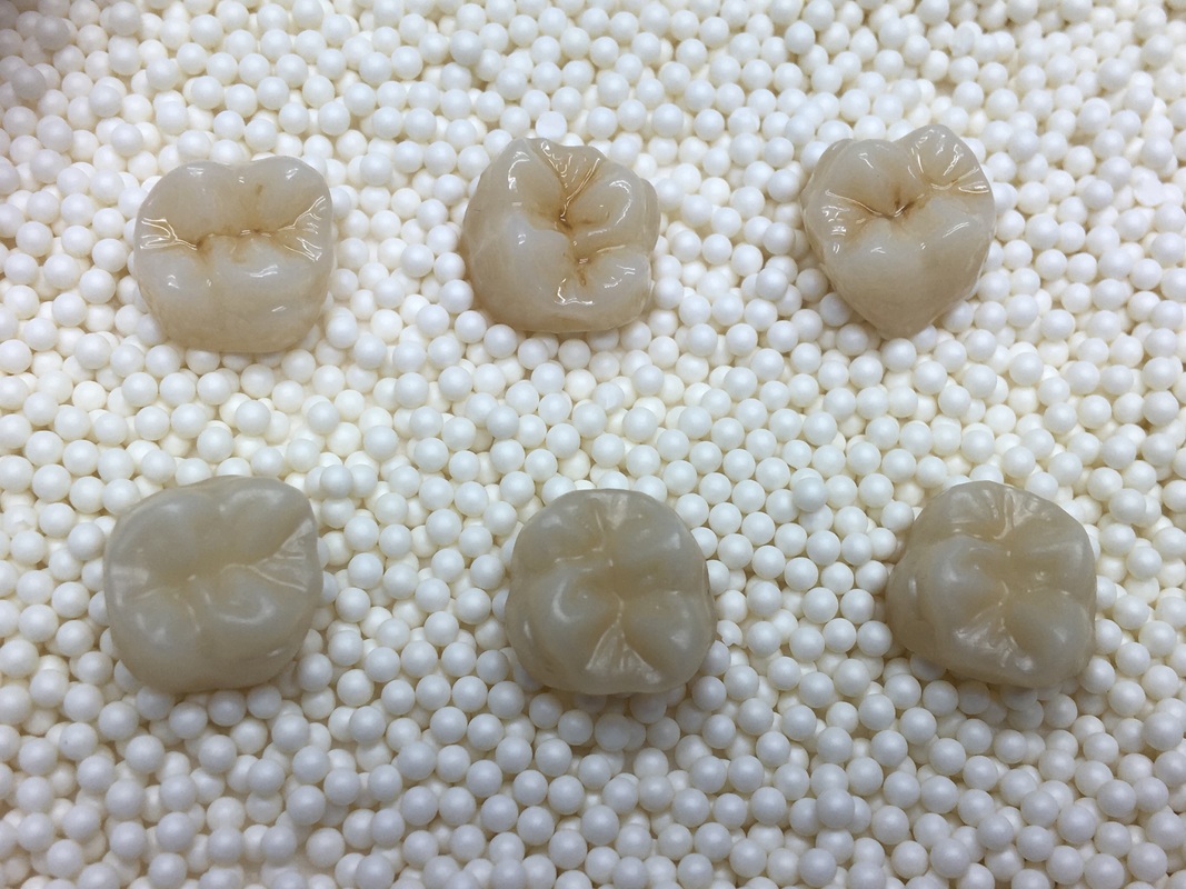 Descubra a Versatilidade das Placas de Zircônia ST Color Yucera para Coroas e Pontes Dentárias